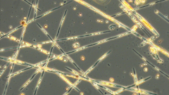 Mixed species bloom of Pseudo-nitzschia © SAMS